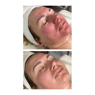Repair Mask Post-Procedure | Maska po zabiegu łagodząca podrażnienia | JeuDerm