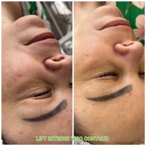 Lift Intense Viso Contour | Maska liftingująca peptydowo-enzymatyczna | JeuDerm Lift Intense Viso Contour | Maska liftingująca peptydowo-enzymatyczna | JeuDerm
