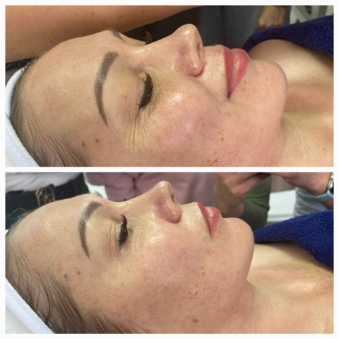 Lift Intense Viso Contour | Maska liftingująca peptydowo-enzymatyczna | JeuDerm Lift Intense Viso Contour | Maska liftingująca peptydowo-enzymatyczna | JeuDerm